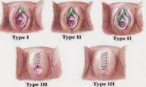 Травмы женских половых органов во время секса: причины, симптомы, лечение Дефект малых половых губ